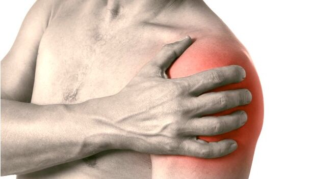 A swollen, red and enlarged shoulder - symptoms of grade 2-3 osteoarthritis of the shoulder joint