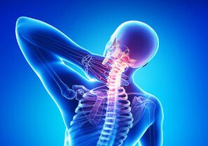 Signs of cervical osteochondrosis