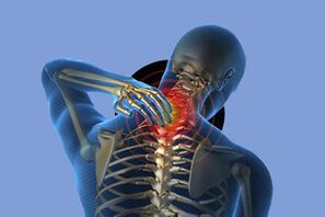 Symptoms of cervical osteochondrosis