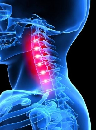Osteochondrosis of the cervical spine