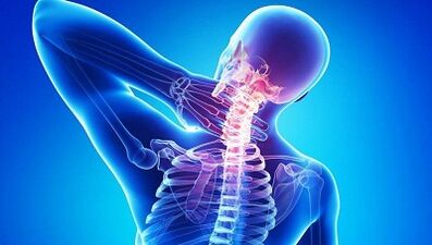 How does osteochondrosis manifest itself
