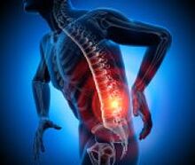 different causes of back pain