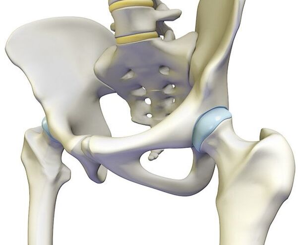 Osteochondrosis provokes a severe pain in the hip joint