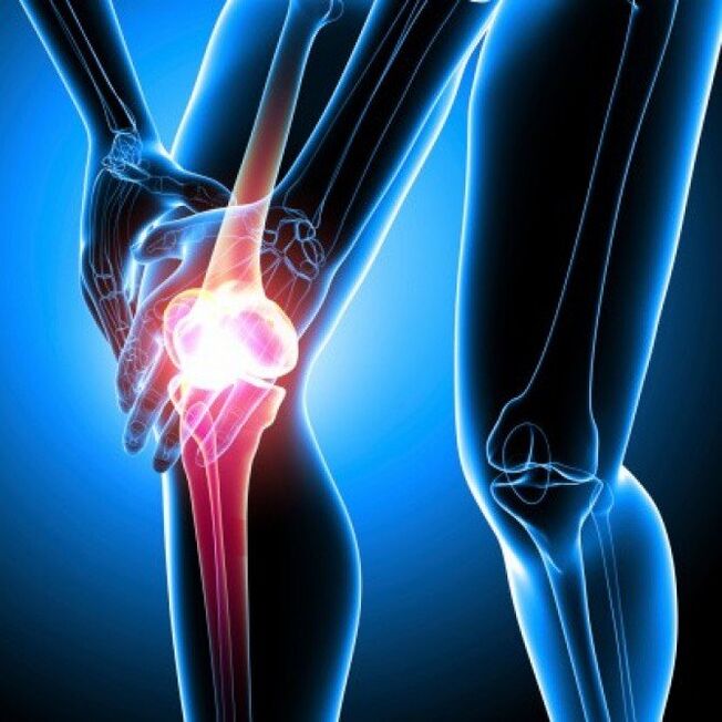 Rheumatoid arthritis in advanced stages can cause hip pain